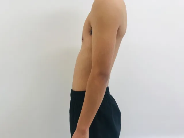 姿勢が原因の症状:腰痛・反り腰